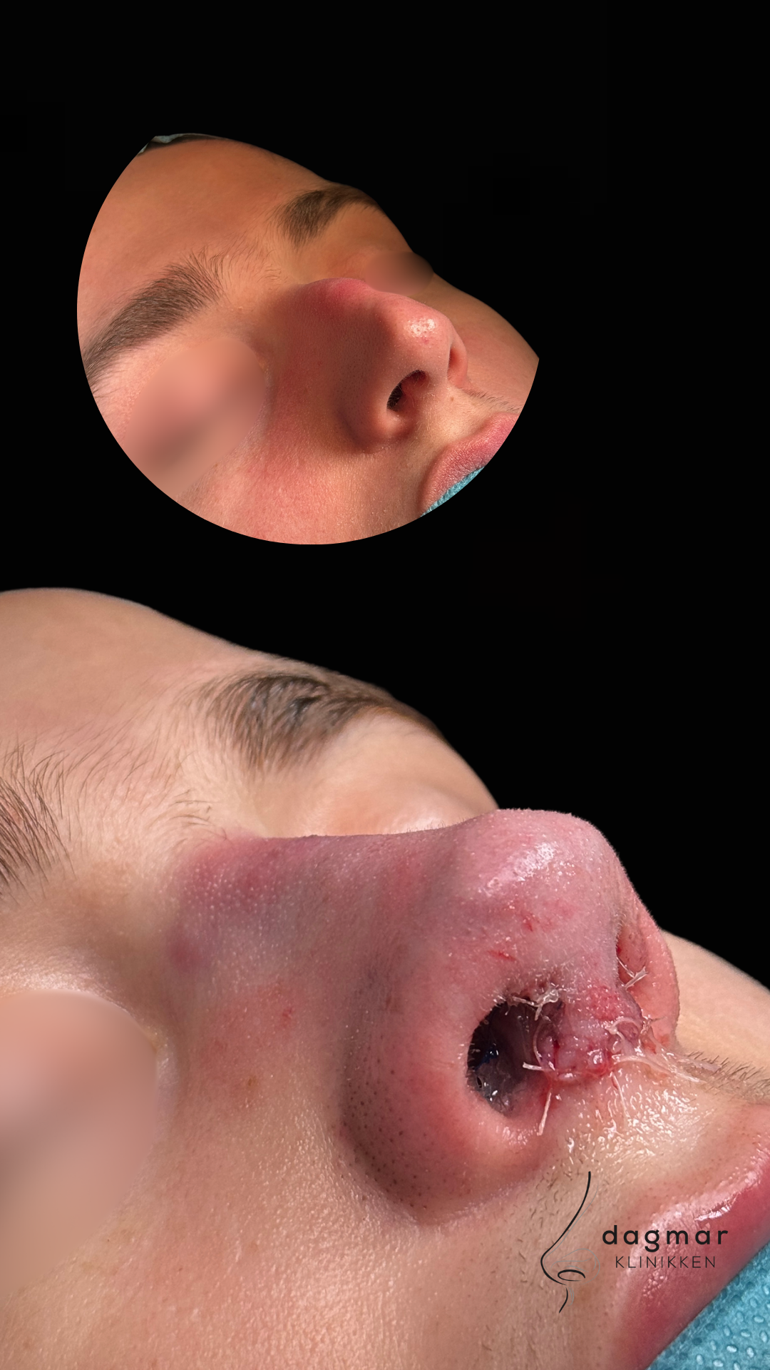 Patient 2 - Skrå vinkel