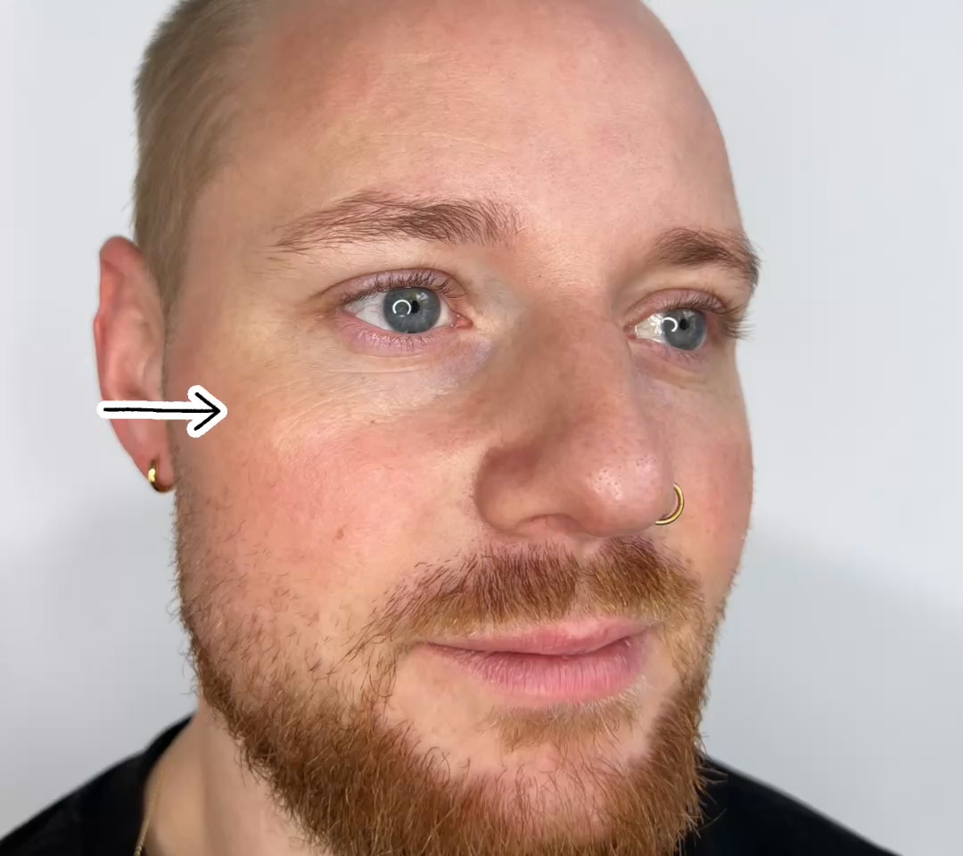 Før behandling