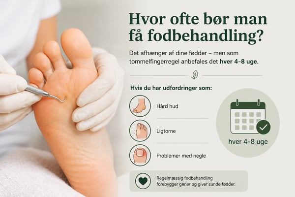 Hvor ofte bør man få fodbehandling?