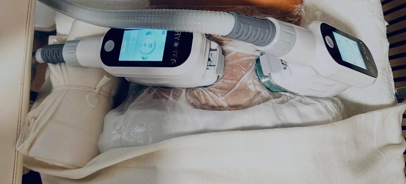 Fedtfrysning behandling med professionelle applikatorer og beskyttende gelmembran hos Cryo by Breum i Odense