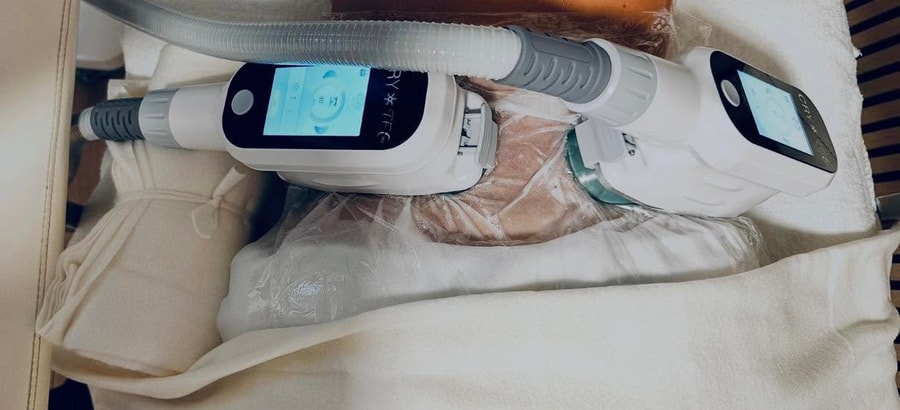 Fedtfrysning behandling med professionelle applikatorer og beskyttende gelmembran hos Cryo by Breum i Odense